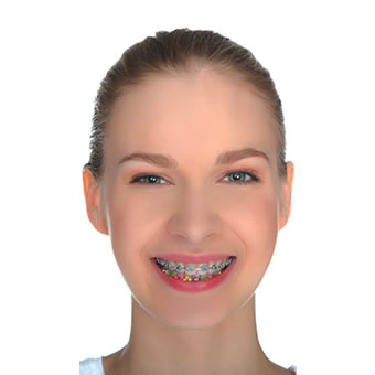 Ortodontik Tedavide Yaş Faktörü